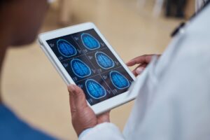 Doctor holding an iPad with a brain scan